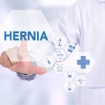 Do I Need Hernia Surgery?