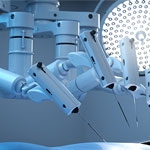 The Benefits of Robotic Surgery
